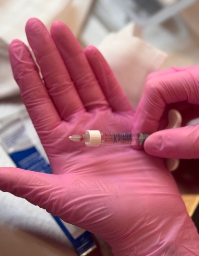 An image of a needle used to carry out a type of aesthetic treatment